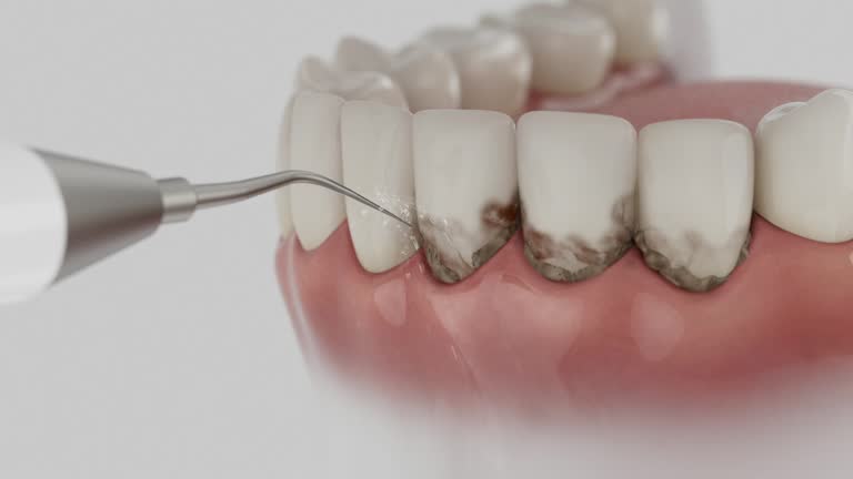 Reliable Dental contractor in Eden, TX by Smile Center Dentistry
